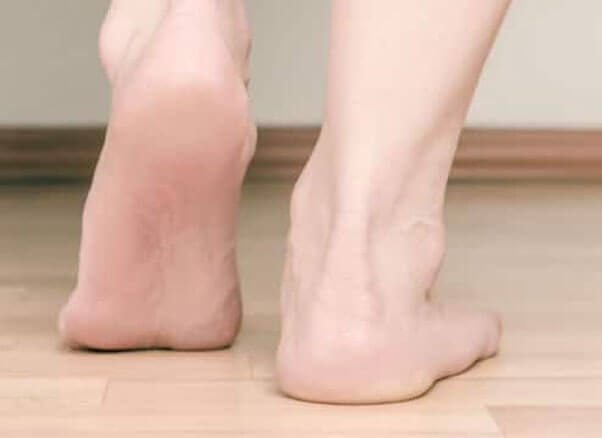 Flat Feet Treatment in the Memphis, TN 38117 area