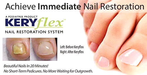 Keryflex Nail Restoratio